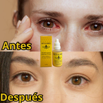 OFTALMIEL™🐝- GOTAS MÁGICAS + ENVÍO GRATIS 🎁